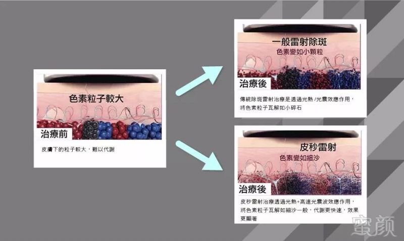 https://img.miyanlife.com/mnt/timg/180823/12323310L-3.jpg