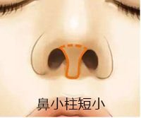 https://img.miyanlife.com/mnt/timg/180823/1232394250-2.jpg