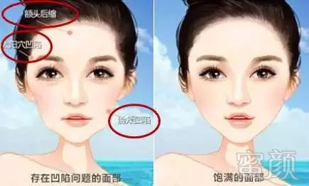 https://img.miyanlife.com/mnt/timg/180823/12340441c-0.jpg