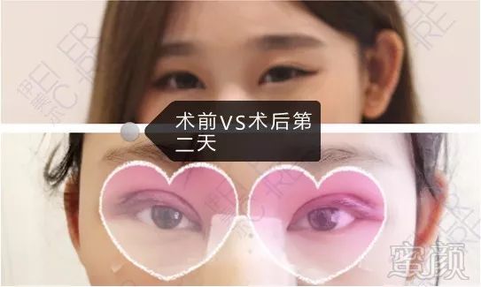 https://img.miyanlife.com/mnt/timg/180823/123HG2Z-13.jpg