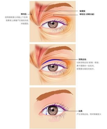 https://img.miyanlife.com/mnt/timg/180823/123HMR1-12.jpg