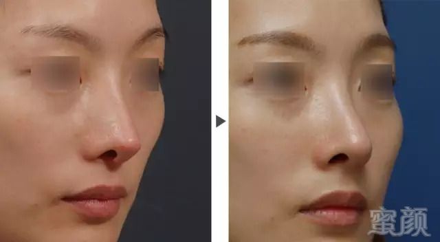 https://img.miyanlife.com/mnt/timg/180824/1044054O7-4.jpg