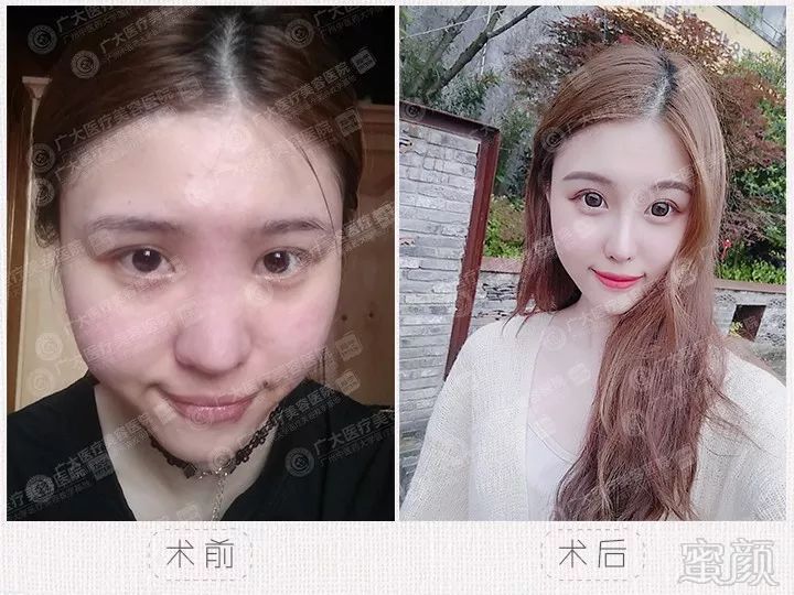https://img.miyanlife.com/mnt/timg/180824/1045025052-1.jpg