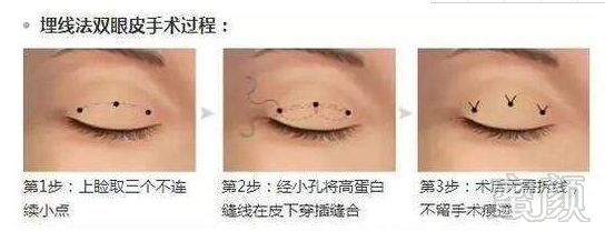 https://img.miyanlife.com/mnt/timg/180824/104AC092-1.jpg