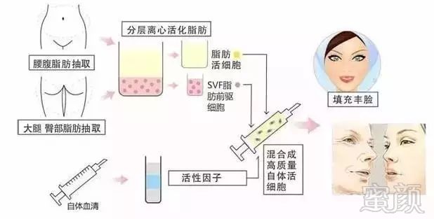 案例图片