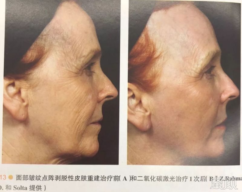 https://img.miyanlife.com/mnt/timg/180824/105U62622-15.jpg