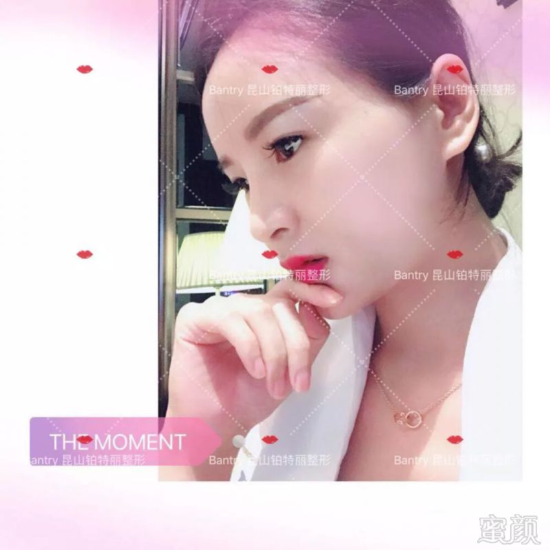 https://img.miyanlife.com/mnt/timg/180824/110T1A10-2.jpg