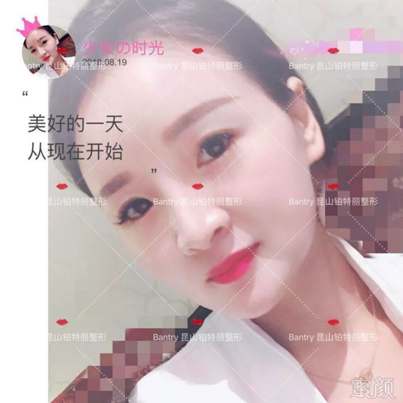 https://img.miyanlife.com/mnt/timg/180824/110T46063-10.jpg
