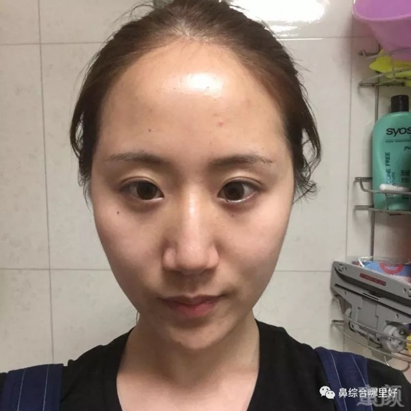 https://img.miyanlife.com/mnt/timg/180824/1123003C7-0.jpg