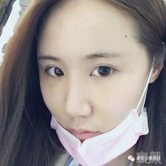 https://img.miyanlife.com/mnt/timg/180824/11230125S-3.jpg