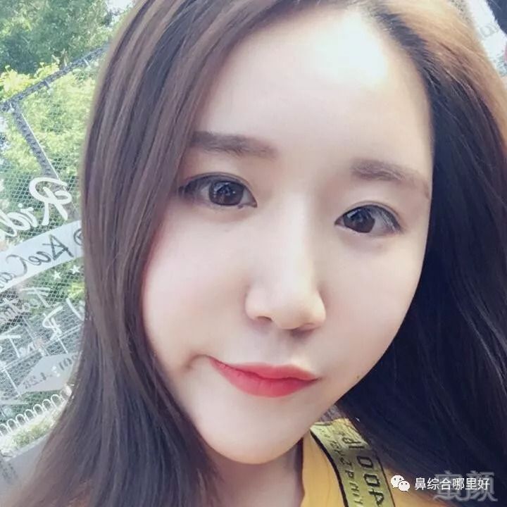 https://img.miyanlife.com/mnt/timg/180824/1123025113-5.jpg