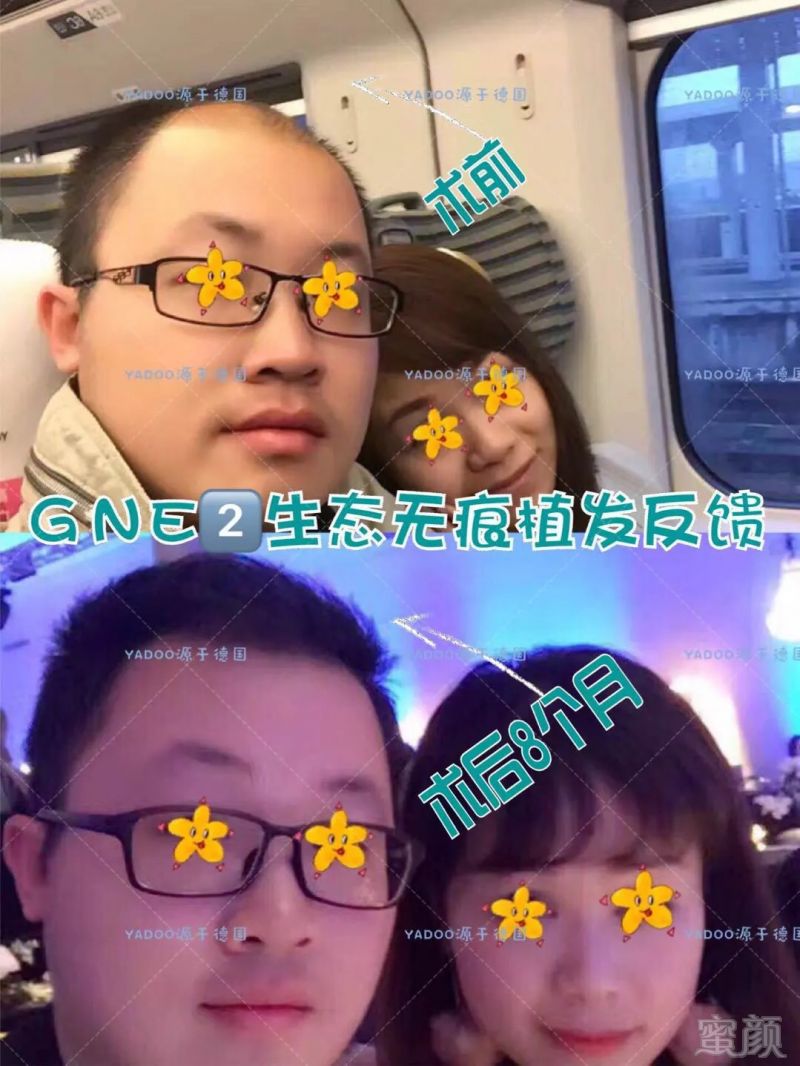 https://img.miyanlife.com/mnt/timg/180824/11402a151-5.jpg