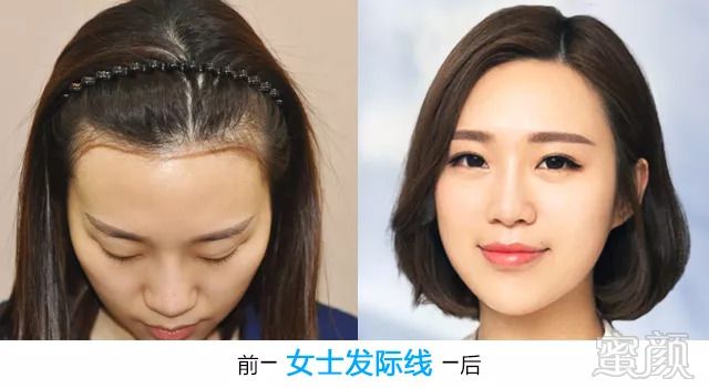https://img.miyanlife.com/mnt/timg/180824/1140301915-6.jpg