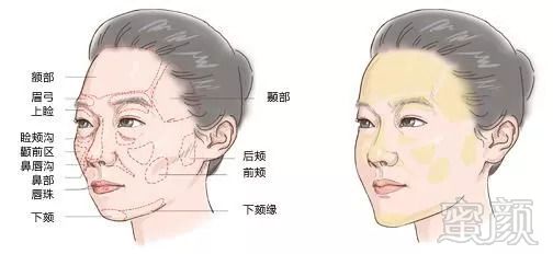 https://img.miyanlife.com/mnt/timg/180824/1150295359-1.jpg