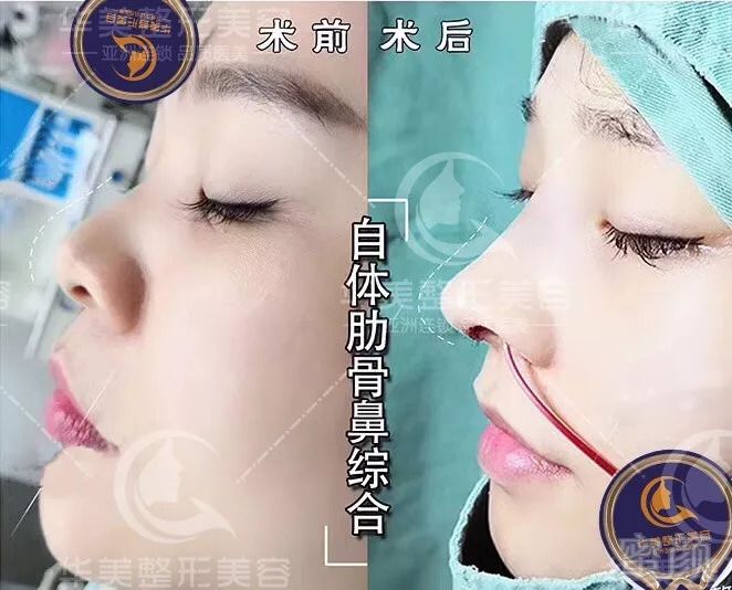 https://img.miyanlife.com/mnt/timg/180824/12041623X-4.jpg