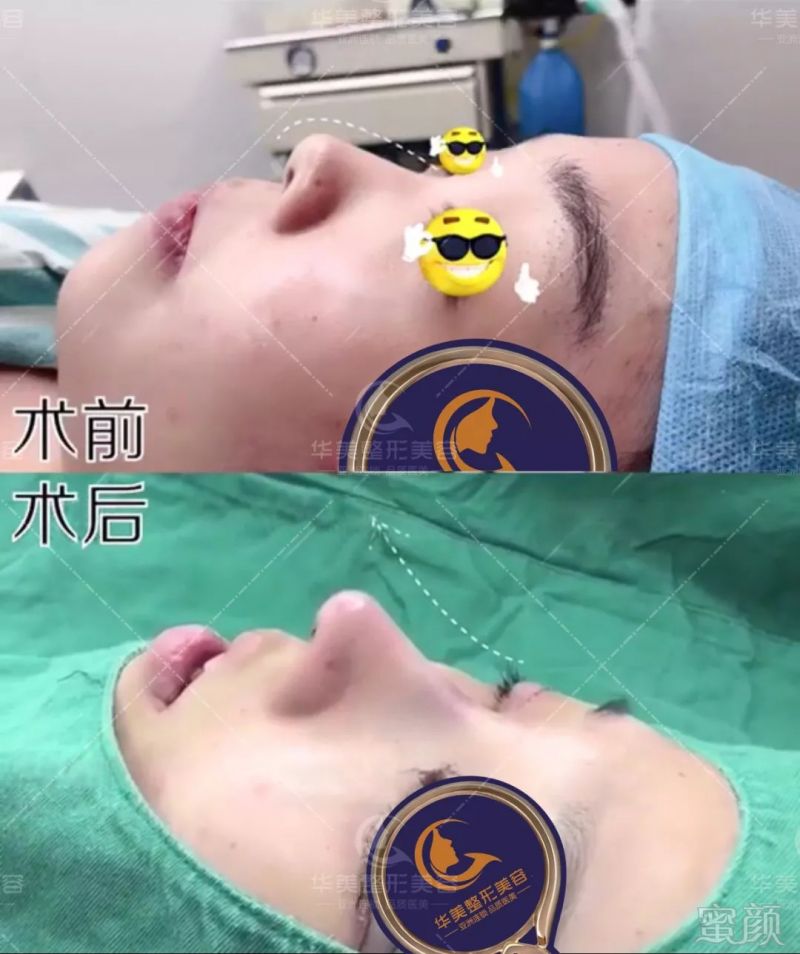 https://img.miyanlife.com/mnt/timg/180824/1204164b8-5.jpg