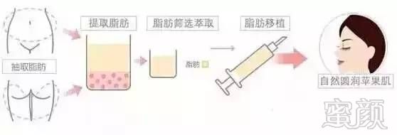 https://img.miyanlife.com/mnt/timg/180824/12120543a-5.jpg