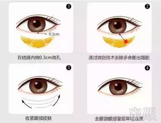https://img.miyanlife.com/mnt/timg/180824/1214043C6-5.jpg