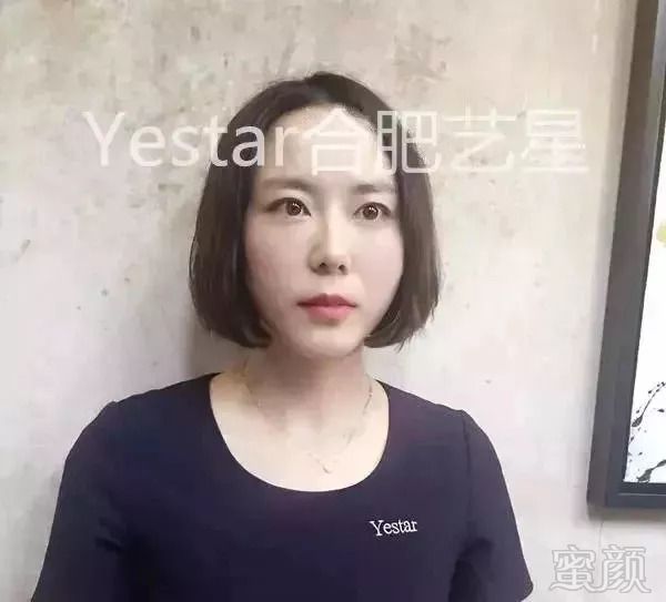 案例图片