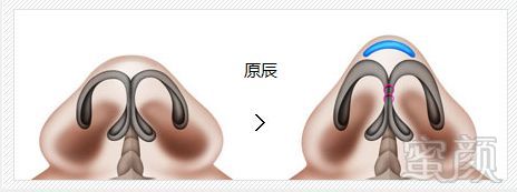 https://img.miyanlife.com/mnt/timg/180824/121T321E-2.jpg