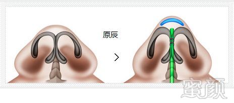 https://img.miyanlife.com/mnt/timg/180824/121T33260-3.jpg