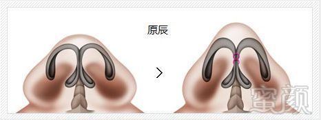 https://img.miyanlife.com/mnt/timg/180824/121T33413-1.jpg