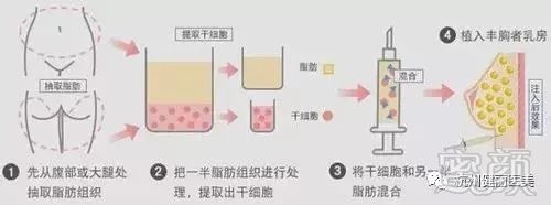 https://img.miyanlife.com/mnt/timg/180825/1216054I1-0.jpg