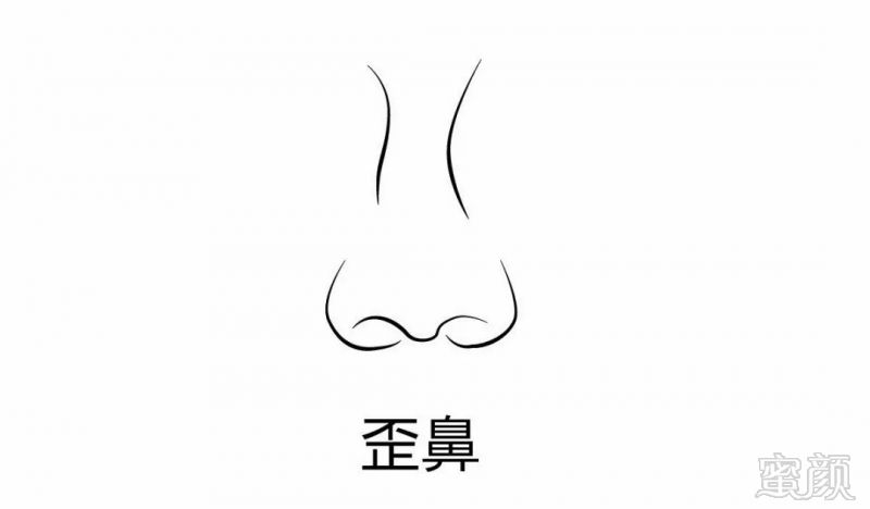 https://img.miyanlife.com/mnt/timg/180825/121SUE0-3.jpg