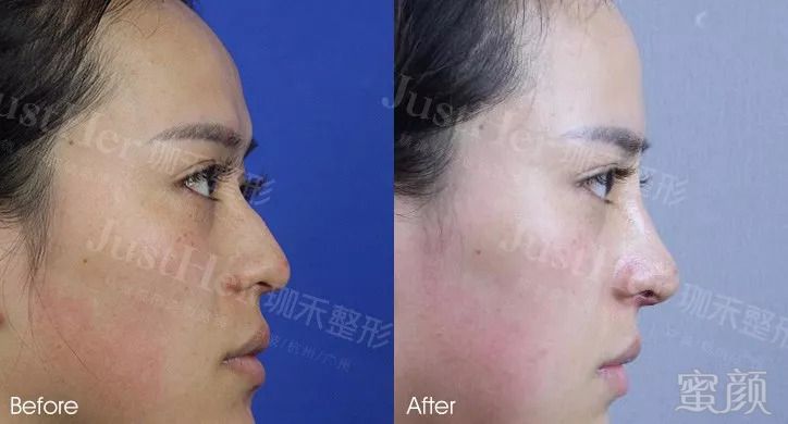 https://img.miyanlife.com/mnt/timg/180825/121T025R-8.jpg