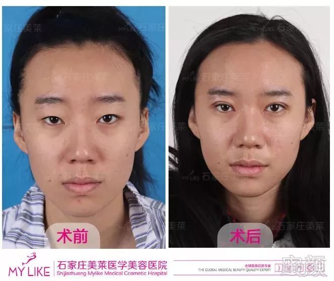 https://img.miyanlife.com/mnt/timg/180825/12204520U-4.jpg