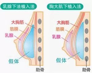 案例图片