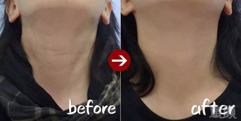 https://img.miyanlife.com/mnt/timg/180825/1241461B4-9.jpg