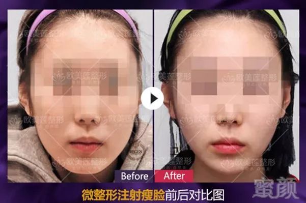 https://img.miyanlife.com/mnt/timg/180825/124304O22-4.jpg