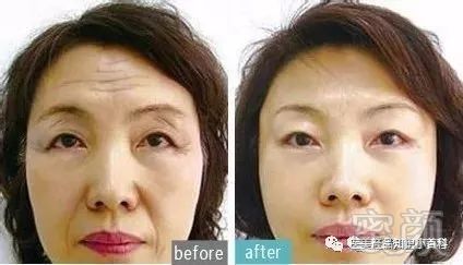 https://img.miyanlife.com/mnt/timg/180825/124359E12-2.jpg