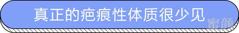 https://img.miyanlife.com/mnt/timg/180825/124921IM-7.jpg