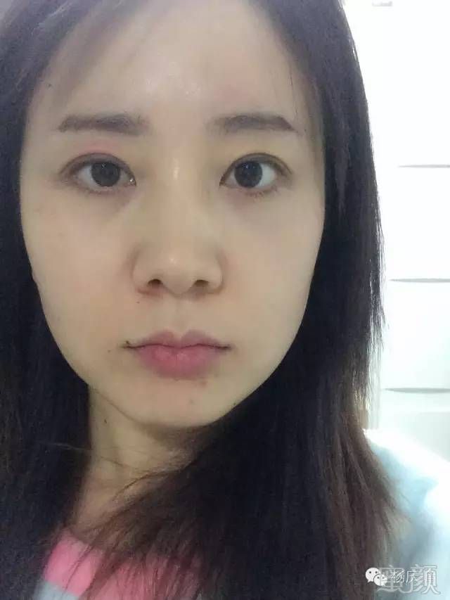 https://img.miyanlife.com/mnt/timg/180825/124ZS255-9.jpg