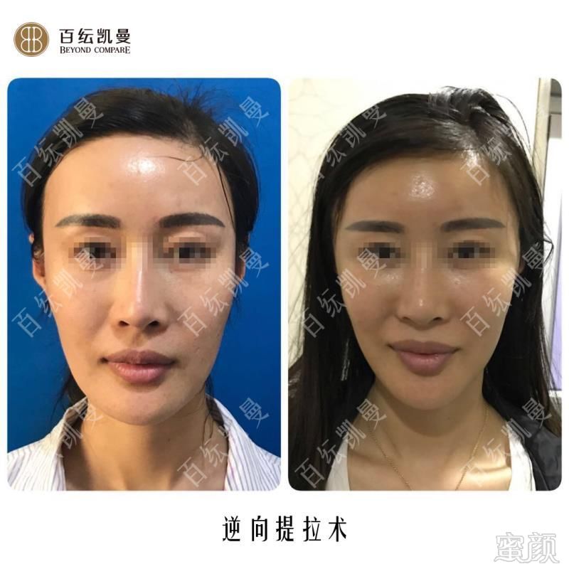 https://img.miyanlife.com/mnt/timg/180825/1330024A4-7.jpg