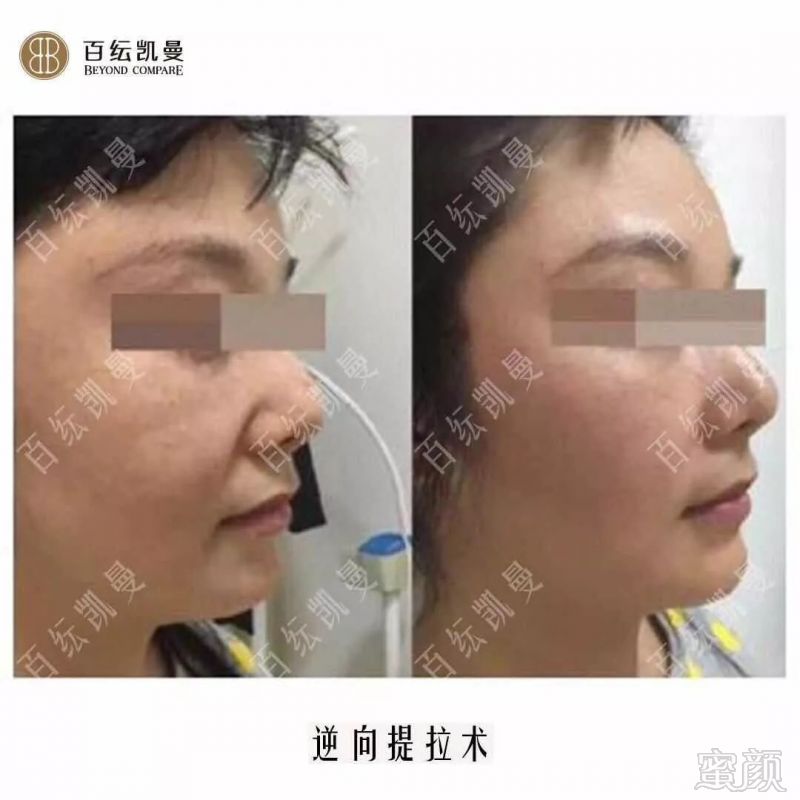 https://img.miyanlife.com/mnt/timg/180825/13300IH8-9.jpg