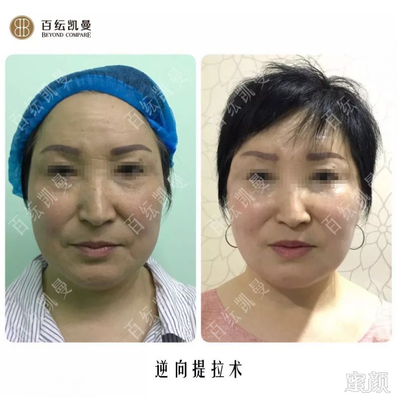 https://img.miyanlife.com/mnt/timg/180825/1330121646-11.jpg
