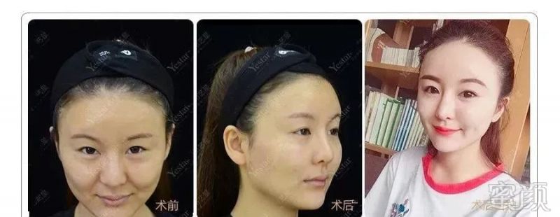 https://img.miyanlife.com/mnt/timg/180825/13362a056-4.jpg
