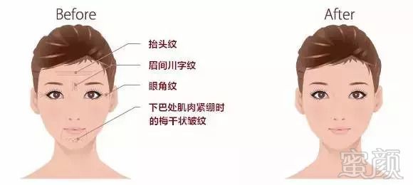 https://img.miyanlife.com/mnt/timg/180825/1339592304-7.jpg