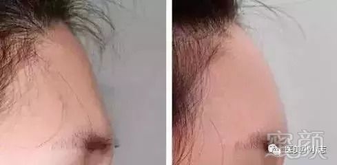 https://img.miyanlife.com/mnt/timg/180825/133AK353-2.jpg