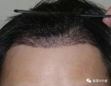 https://img.miyanlife.com/mnt/timg/180825/133Aa328-9.jpg