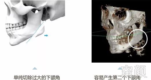 https://img.miyanlife.com/mnt/timg/180825/13410S532-10.jpg