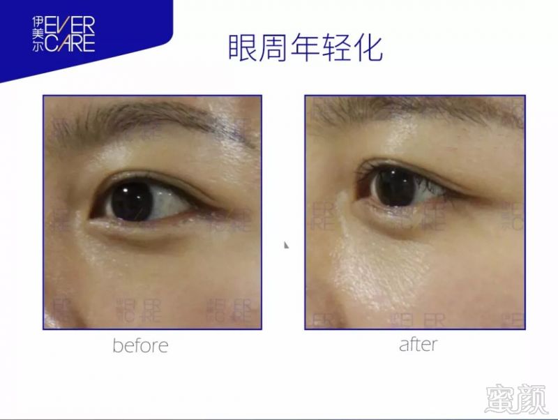 https://img.miyanlife.com/mnt/timg/180825/1344561312-2.jpg