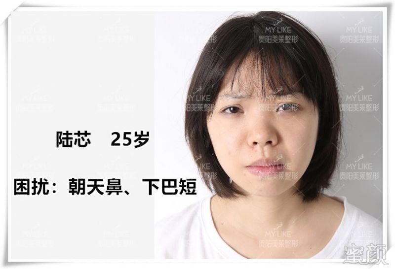 https://img.miyanlife.com/mnt/timg/180825/1400364146-2.jpg