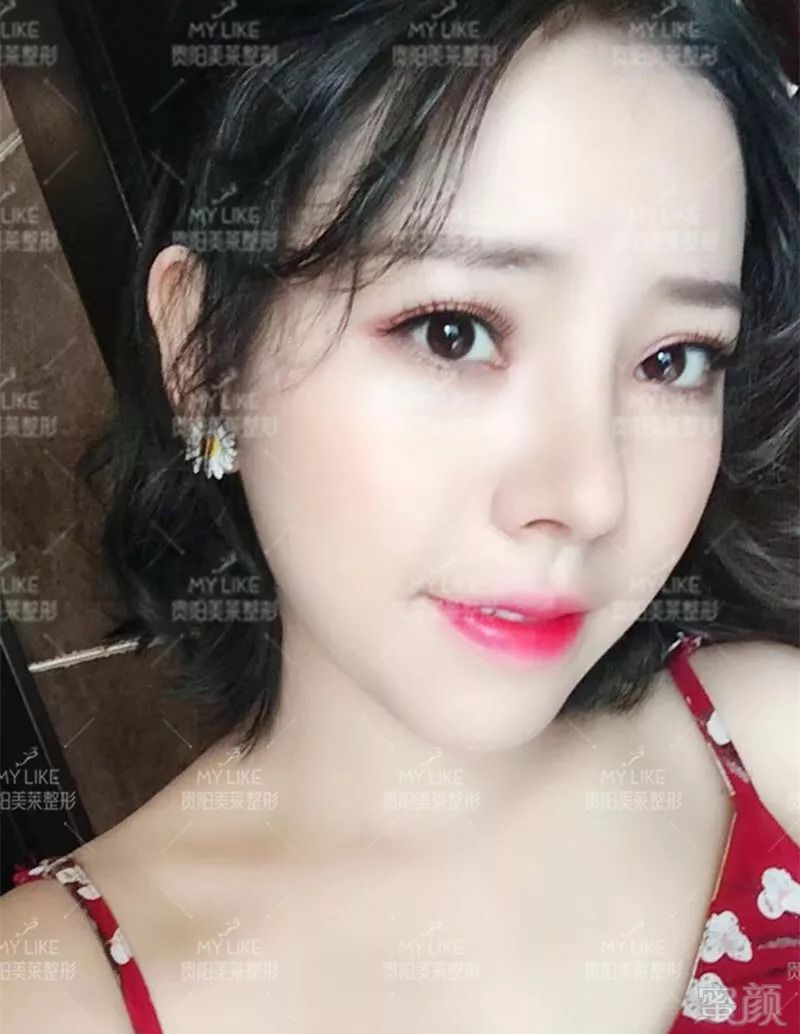 https://img.miyanlife.com/mnt/timg/180825/1400391002-8.jpg