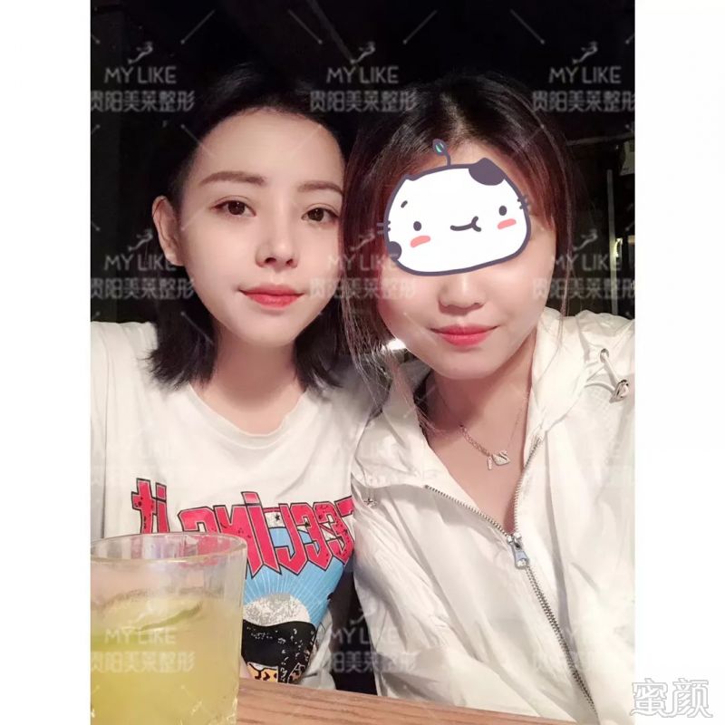 https://img.miyanlife.com/mnt/timg/180825/14003a315-7.jpg