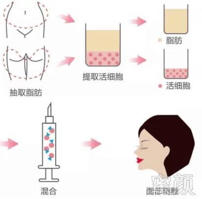 https://img.miyanlife.com/mnt/timg/180825/1402551401-2.jpg