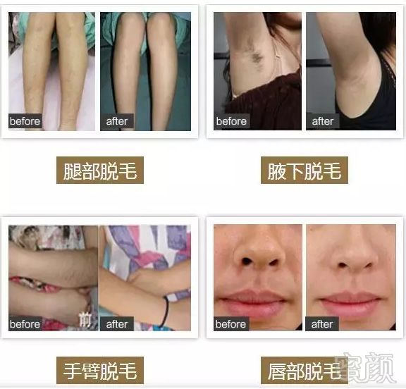 https://img.miyanlife.com/mnt/timg/180825/1403192237-4.jpg